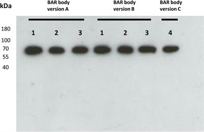 Integration of the B-Cell Receptor Antigen Neurabin-I/SAMD14 Into an Antibody Format as New Therapeutic Approach for the Treatment of Primary CNS Lymphoma